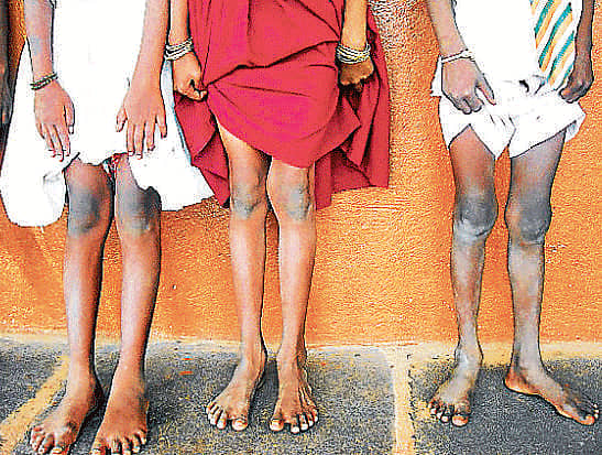 ಮದ್ದು ಇಲ್ಲದ ಕಾಯಿಲೆ ಜೊತೆ ಗುದ್ದಾಟ