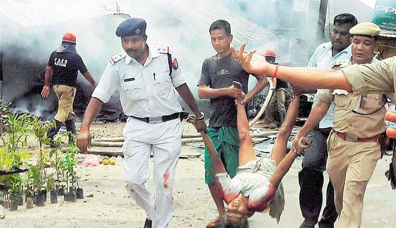 ಗಾಯಾಳುವನ್ನು ಭದ್ರತಾ ಸಿಬ್ಬಂದಿ ಆಸ್ಪತ್ರೆಗೆ ಸಾಗಿಸಿದರು