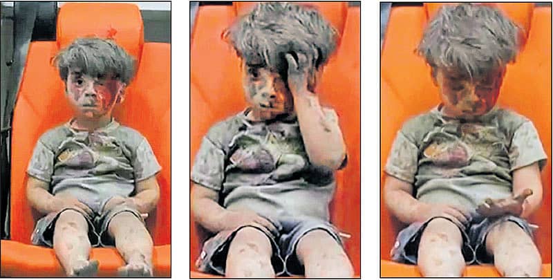 ವೈಮಾನಿಕ ದಾಳಿಯಲ್ಲಿ ಗಾಯಗೊಂಡು ಆಂಬುಲೆನ್ಸ್ನಲ್ಲಿ ಕುಳಿತಿರುವ ಬಾಲಕ ಒಮ್ರಾನ್ನ ವಿವಿಧ ಭಂಗಿಗಳು