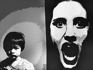 ನಗರವಾಸಿ ಚಿಣ್ಣರನ್ನೂ ಕಾಡುವ ಅಪೌಷ್ಟಿಕತೆ