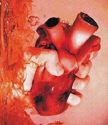 ಮುಕ್ತಛಂದ: ಕಲ್ಲಾಗು ಕಷ್ಟಗಳ ಮಳೆ ವಿಧಿ ಸುರಿಯೆ...