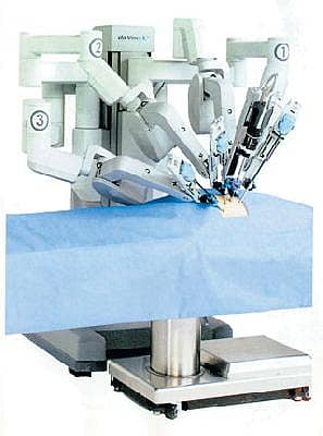 ರೋಬೊ ಸರ್ಜರಿ