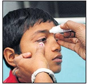 ಪಟಾಕಿ: 30ಕ್ಕೂ ಹೆಚ್ಚು ಗಾಯ