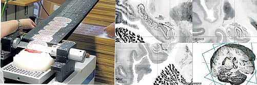 `ಬಿಗ್ ಬ್ರೈನ್' ಅಭಿವೃದ್ಧಿಪಡಿಸುವ ವೇಳೆ ವಿಜ್ಞಾನಿಗಳು ಫ್ಯಾರಫೀನ್‌ನಿಂದ (ಕಲ್ಲೆಣ್ಣೆ ಮೇಣ) ಸಂರಕ್ಷಿಸಿಡಲಾಗಿದ್ದ ಮಿದುಳನ್ನು ಮೈಕ್ರೋಟೋಮ್‌ನಿಂದ (ಸೂಕ್ಷ್ಮದರ್ಶಕಕ್ಕಾಗಿ ಅತ್ಯಂತ ತೆಳುಹಾಳೆಗಳನ್ನು ಕತ್ತರಿಸುವ ಉಪಕರಣ) 20 ಮೈ.ಮೀ. ಗಾತ್ರದಲ್ಲಿ ಸೀಳುತ್ತಿರುವುದು (ಎಡಚಿತ್ರ). ಮಿದುಳಿನ ಎರಡು ಪಾರ್ಶ್ವಗಳ ರಚನೆಯ ಕುರುಹುಗಳನ್ನು ತೋರಿಸುವ ವಿಡಿಯೊ ದೃಶ್ಯಾವಳಿಯ ಚಿತ್ರ