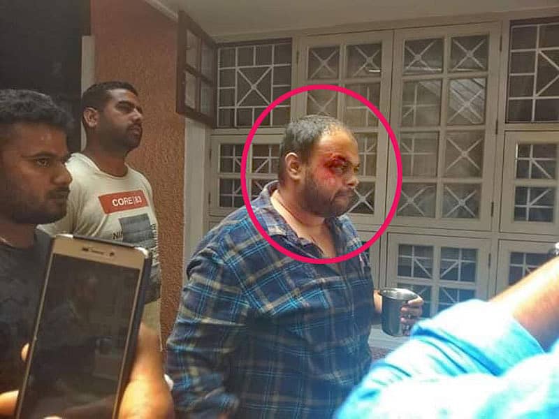 ಕಲ್ಲಿನ ಏಟು ಬಿದ್ದು ಬಿಜೆಪಿಯ ರಾಹುಲ್ ಕಿಣಿ ಗಾಯಗೊಂಡಿರುವುದು.