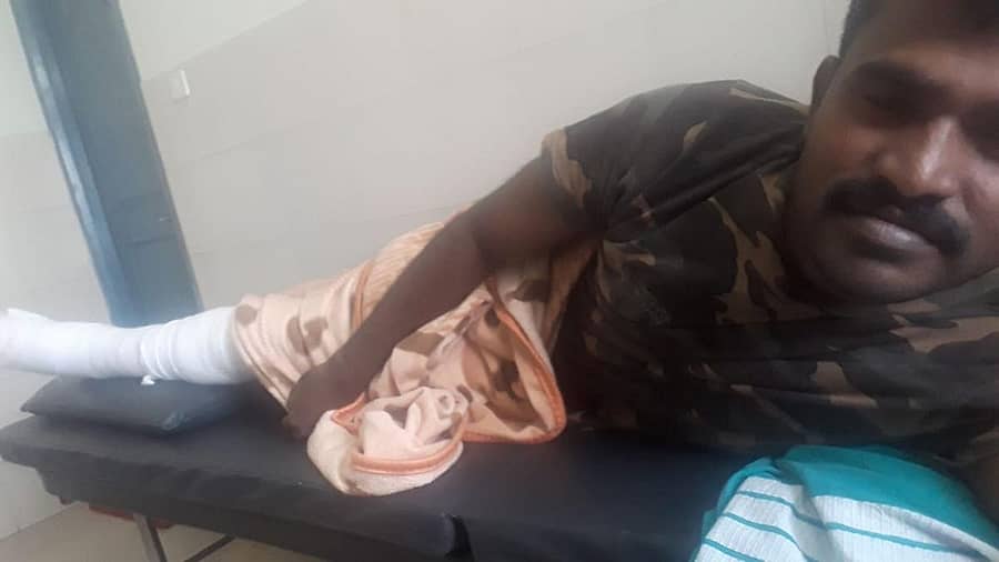 ಕಾಡಾನೆ ಓಡಿಸುವಾಗ ಕಾಲಿಗೆ ಗಾಯವಾಗಿರುವ ಉಪವಲಯ ಅರಣ್ಯಾಧಿಕಾರಿ ಬಸವರಾಜ ಪೂಜಾರಿ ಶಿರಸಿಯ ಆಸ್ಪತ್ರೆಯಲ್ಲಿ ಚಿಕಿತ್ಸೆ ಪಡೆಯುತ್ತಿದ್ದಾರೆ