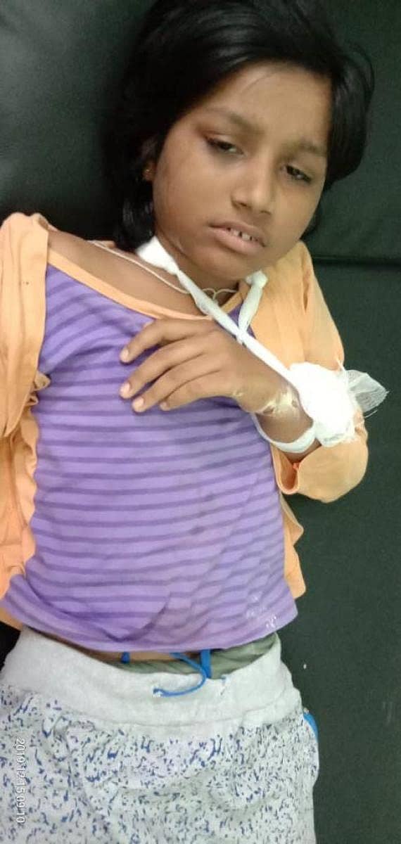 ಬೀದಿನಾಯಿಗಳ ದಾಳಿಯಿಂದ ಗಾಯಗೊಂಡ ಪ್ರೀತಿ