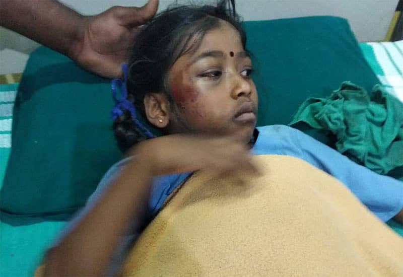 ಆನೆ ದಾಳಿಗೆ ಒಳಗಾದ ಬಾಲಕಿ