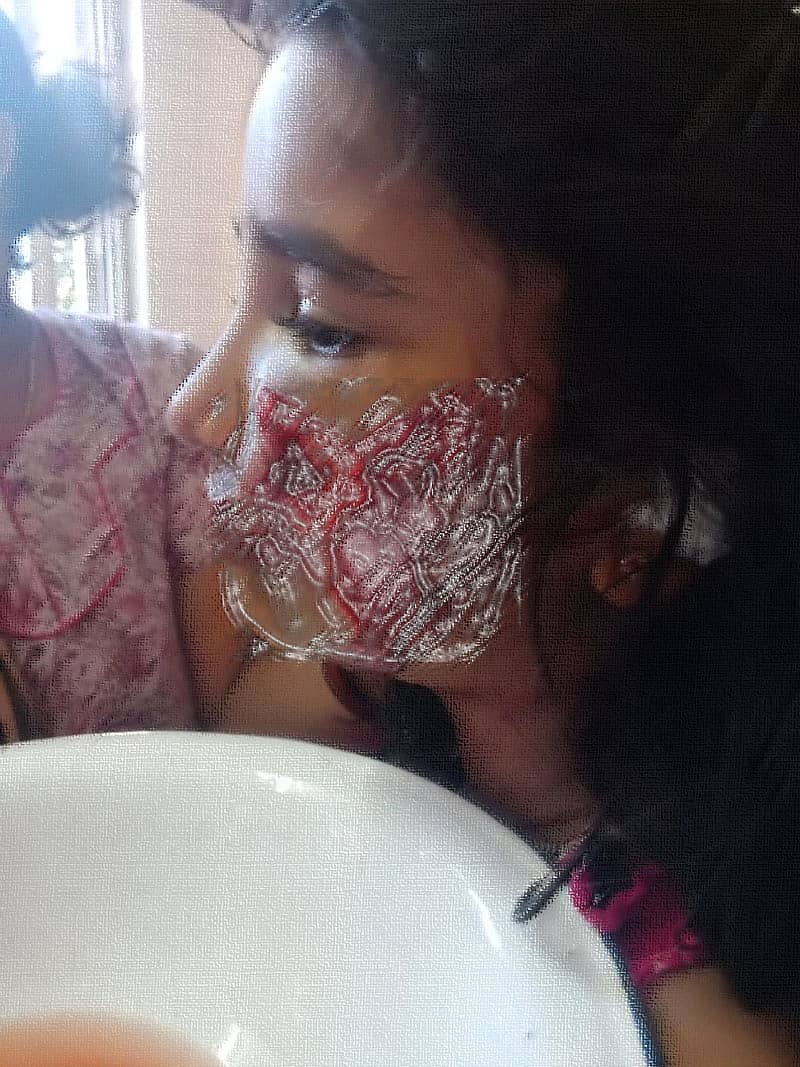 ಗಾಯಗೊಂಡಿರುವ ವಿಧಿಶಾ