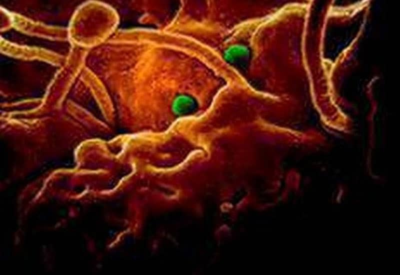 ಕೊರೊನಾ ವೈರಸ್