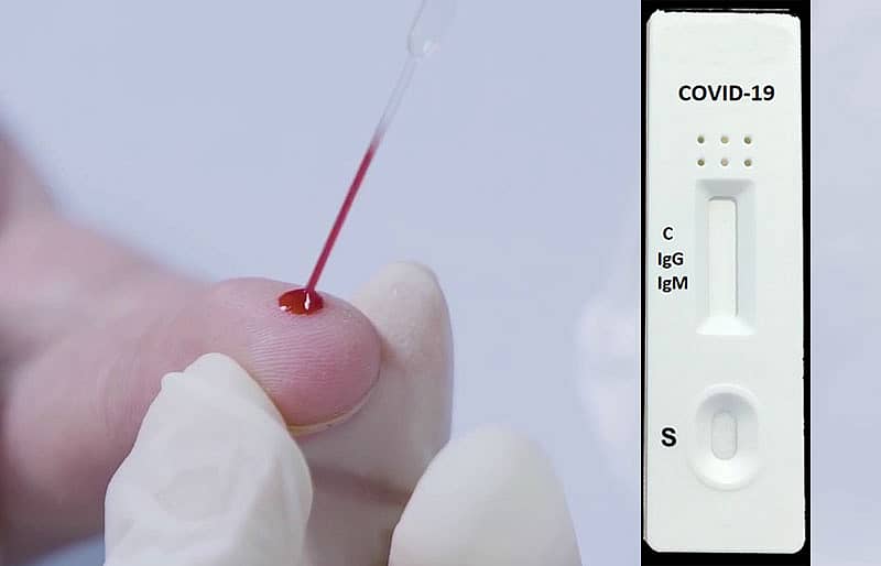 ಬಯೋನ್ ಕಿಟ್ ಬಳಸಿ ಮನೆಯಲ್ಲಿಯೇ ಕೊರೊನಾ ಸೋಂಕು ಪರೀಕ್ಷೆ