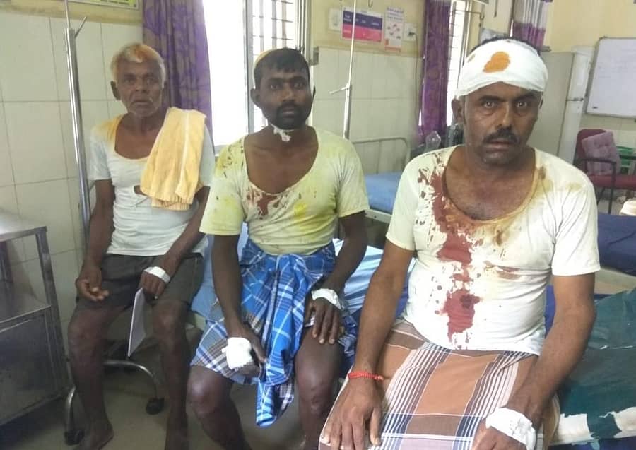 ಕೋಲಾರ ತಾಲ್ಲೂಕಿನ ನಾಚಹಳ್ಳಿಯಲ್ಲಿ ಜಮೀನು ವಿವಾದದ ಸಂಬಂಧ ಬುಧವಾರ ನಡೆದ ಘರ್ಷಣೆಯಲ್ಲಿ ಗಾಯಗೊಂಡು ಎಸ್ಎನ್ಆರ್ ಆಸ್ಪತ್ರೆಗೆ ದಾಖಲಾಗಿರುವ ಸೊಣ್ಣೇಗೌಡ ಮತ್ತು ಕುಟುಂಬ ಸದಸ್ಯರು.