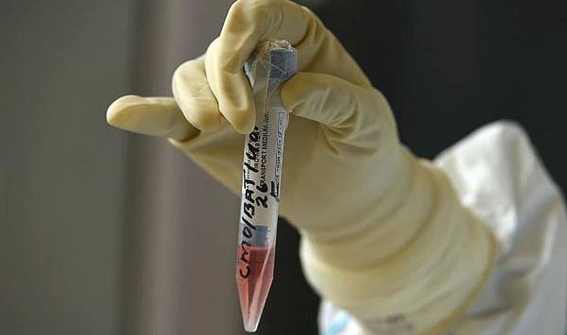 ಸಾಂದರ್ಭಿಕ ಚಿತ್ರ