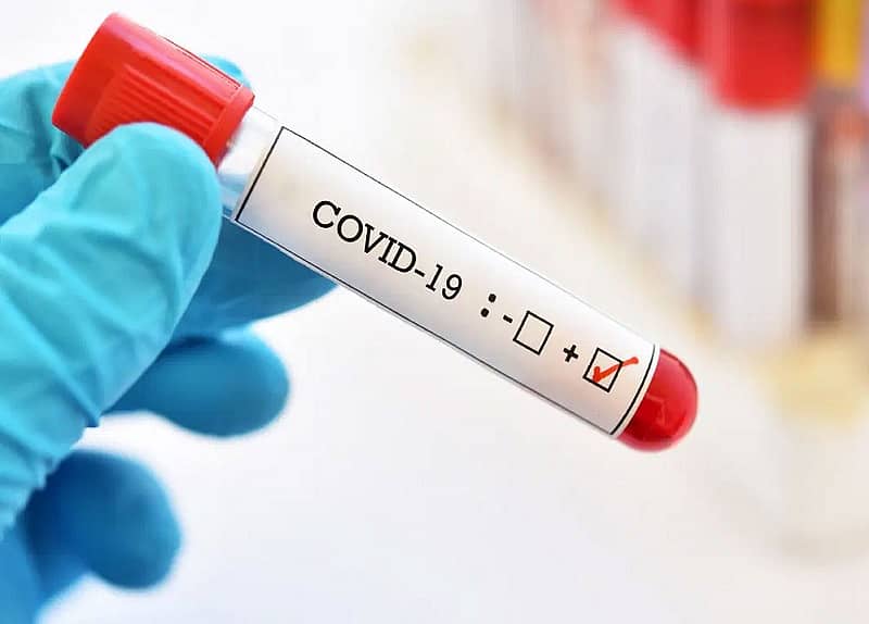 ಸಾಂದರ್ಭಿಕ ಚಿತ್ರ