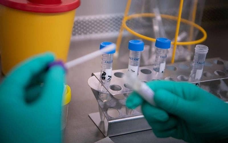 ಕೊರೊನಾ ಪರೀಕ್ಷೆ (ಸಾಂದರ್ಭಿಕ ಚಿತ್ರ)