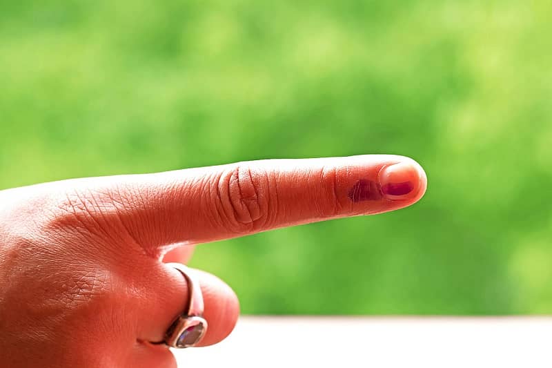 ಸಾಂದರ್ಭಿಕ ಚಿತ್ರ