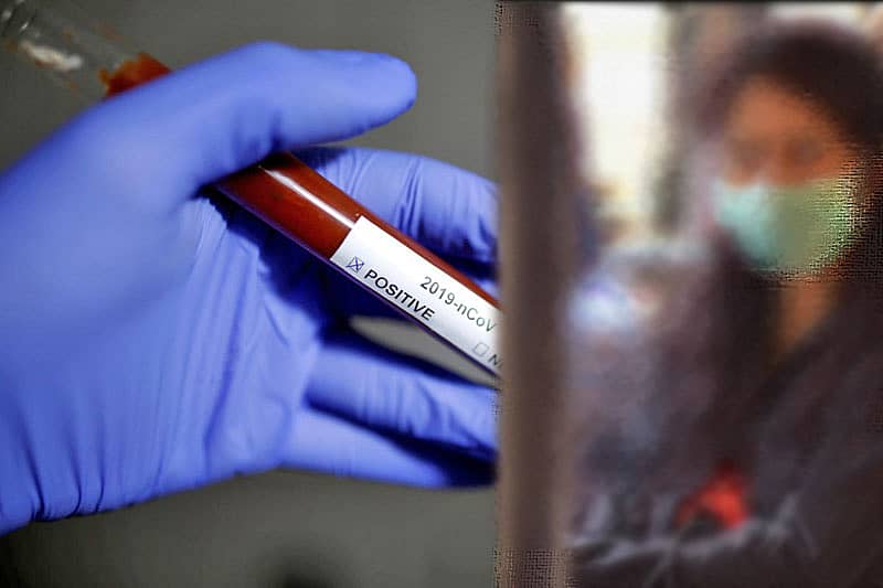 ಸಾಂದರ್ಭಿಕ ಚಿತ್ರ