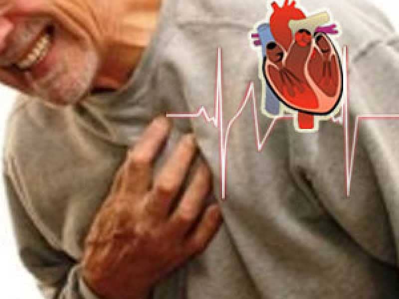 ಹೃದಯಾಘಾತಕ್ಕೆ ಒಳಗಾದ ವ್ಯಕ್ತಿ–ಪ್ರಾತಿನಿಧಿಕ ಚಿತ್ರ