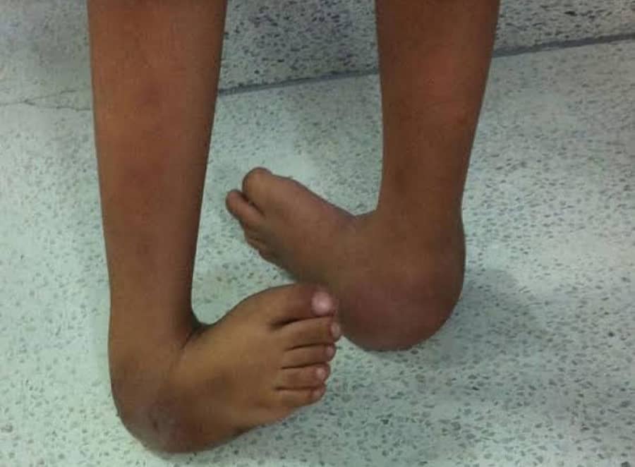 ಸಾಂದರ್ಭಿಕ ಚಿತ್ರ