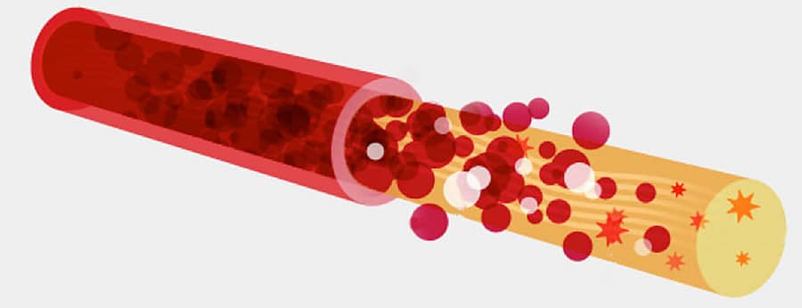 ಸಾಂಕೇತಿಕ ಚಿತ್ರ