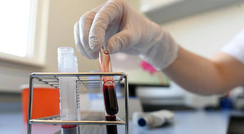 ಸಾಂಕೇತಿಕ ಚಿತ್ರ