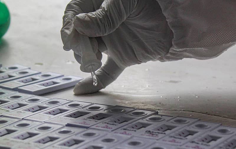 ಕೊರೊನಾ ವೈರಸ್ ಸೋಂಕು ಪರೀಕ್ಷೆ–ಸಾಂದರ್ಭಿಕ ಚಿತ್ರ