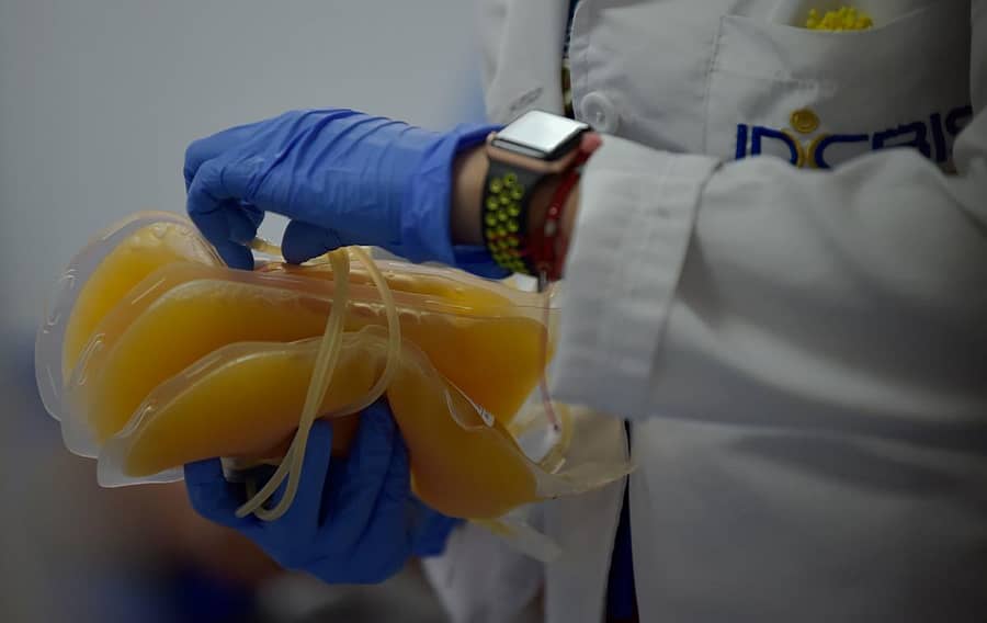 ಪ್ಲಾಸ್ಮಾ ಪೊಟ್ಟಣಗಳು 