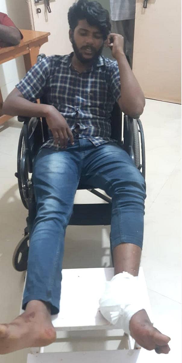 ಪೊಲೀಸರ ಗುಂಡೇಟಿನಿಂದ ಗಾಯಗೊಂಡು ಆಸ್ಪತ್ರೆಯಲ್ಲಿ ಚಿಕಿತ್ಸೆ ಪಡೆಯುತ್ತಿರುವ ಆರೋಪಿಗಳಾದ ಹೇಮಂತ್ ಮತ್ತು ಸೋನು