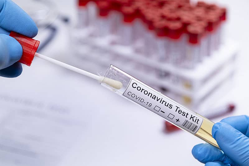 ಸಾಂಕೇತಿಕ ಚಿತ್ರ