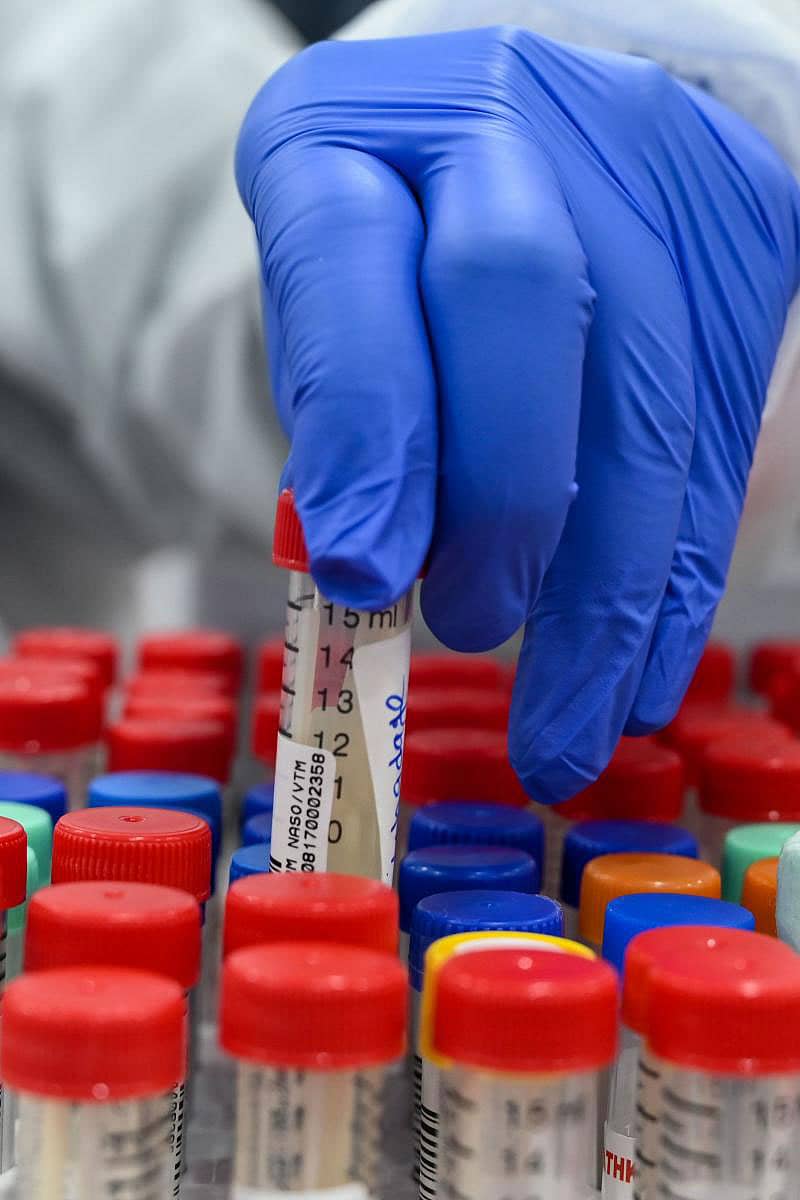 ಕೊರೊನಾವೈರಸ್