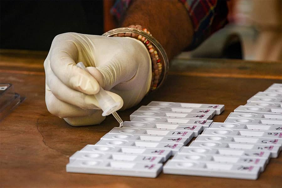 ಕೊರೊನಾ ವೈರಸ್ ಸೋಂಕು ಪರೀಕ್ಷೆ