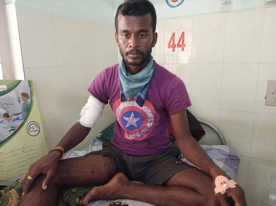 ಗಂಗಾವತಿ ತಾಲ್ಲೂಕಿನ ಬಂಡ್ರಾಳ ಗ್ರಾಮದ ಇಬ್ಬರ ಮೇಲೆ ಭಾನುವಾರ ಮಧ್ಯರಾತ್ರಿ ಕರಡಿ ದಾಳಿ ನಡೆಸಿದೆ