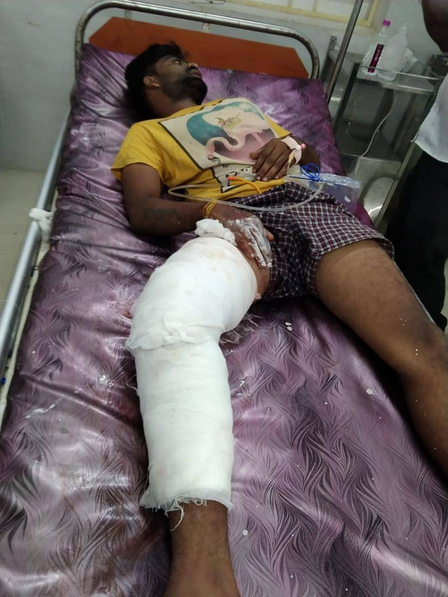 ಗುಂಡೇಟಿನಿಂದ ಗಾಯಗೊಂಡು ಆಸ್ಪತ್ರೆಯಲ್ಲಿ ಚಿಕಿತ್ಸೆ ಪಡೆಯುತ್ತಿರುವ ಆರೋಪಿ ಸುನಿಲ್‌
