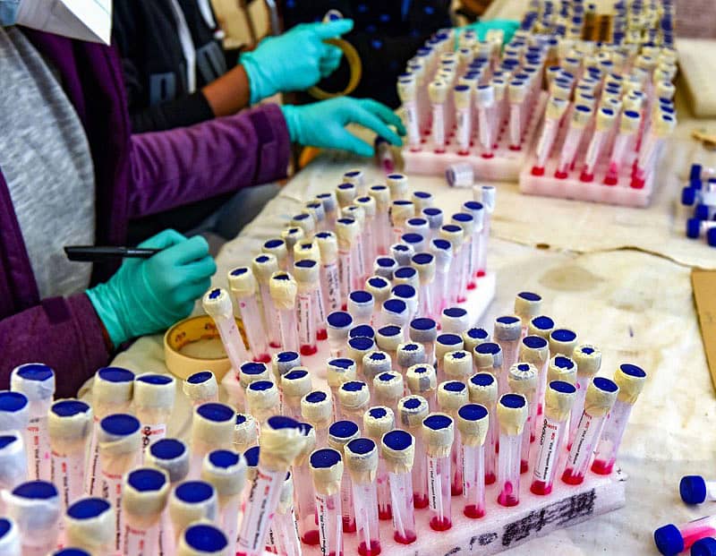 ಕೊರೊನಾ ವೈರಸ್‌ ಸೋಂಕು ಪರೀಕ್ಷೆಗೆ ಗಂಟಲು ದ್ರವ ಮಾದರಿ ಸಂಗ್ರಹ–ಸಾಂದರ್ಭಿಕ ಚಿತ್ರ