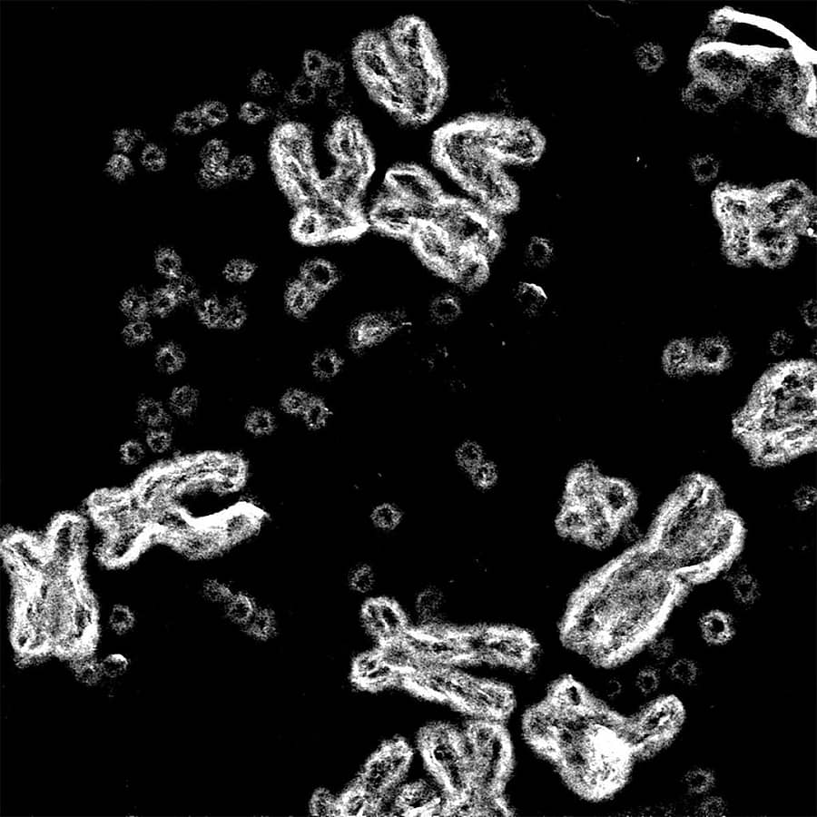 ಸಾಂದರ್ಭಿಕ ಚಿತ್ರ