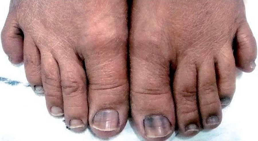 ಪ್ರಾತಿನಿಧಿಕ ಚಿತ್ರ