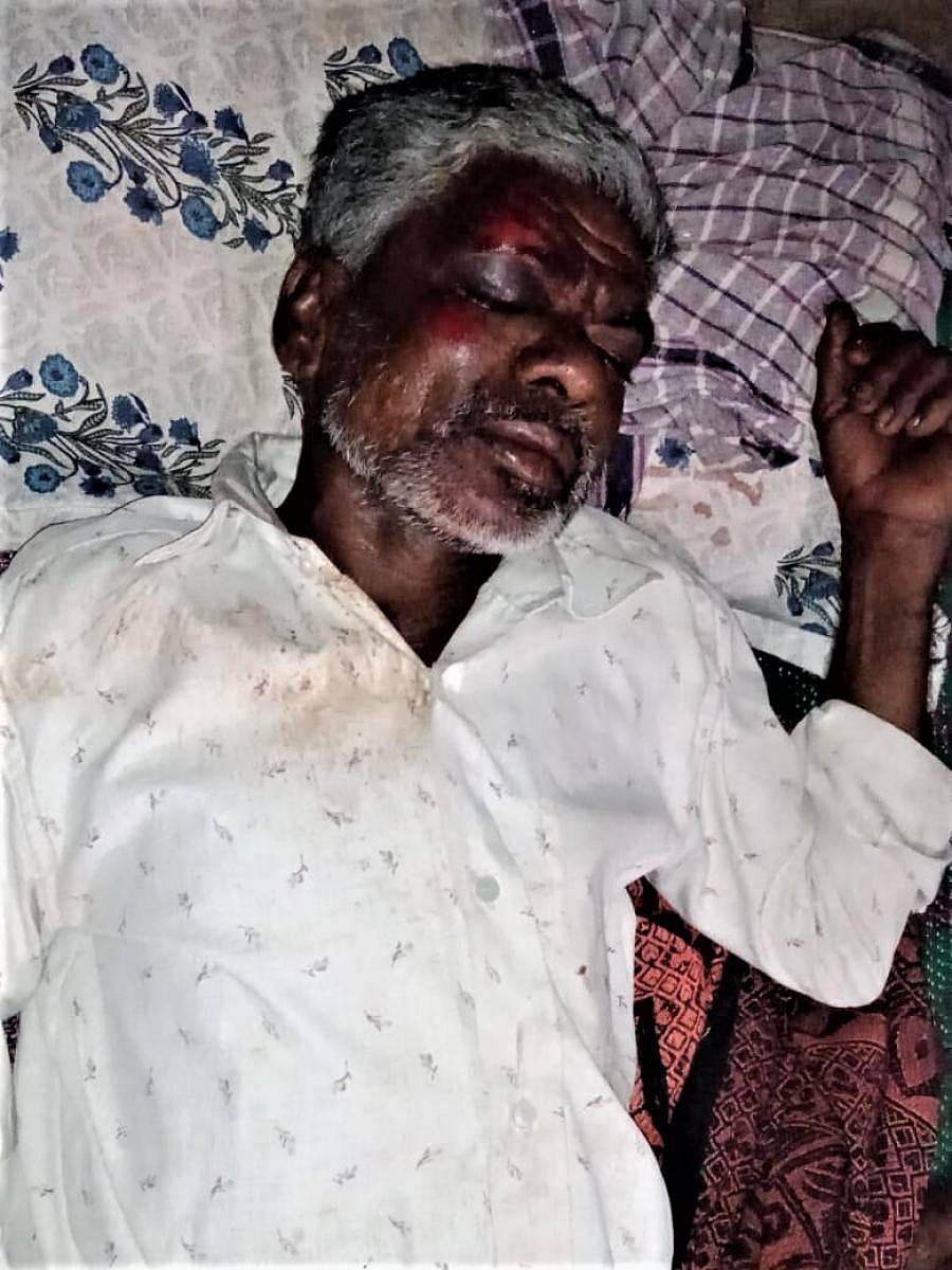 ಕಾಡಾನೆ ದಾಳಿಯಲ್ಲಿ ಗಾಯಗೊಂಡಿರುವ ಕೊಂಡಯ್ಯ