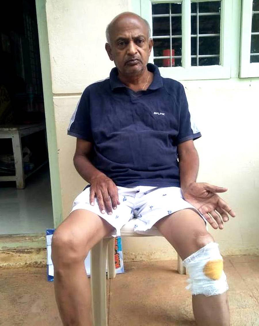 ನಾಯಿ ದಾಳಿಗೆ ಒಳಗಾಗಿರುವ ಎಂ.ಎಸ್.ರಮೇಶ್