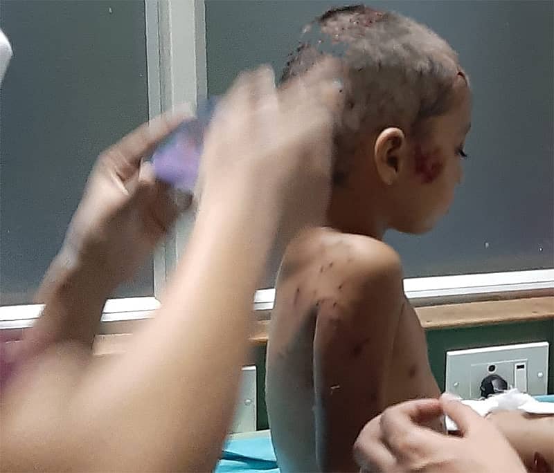 ಸಂತ್ರಸ್ತ ಬಾಲಕಿ 