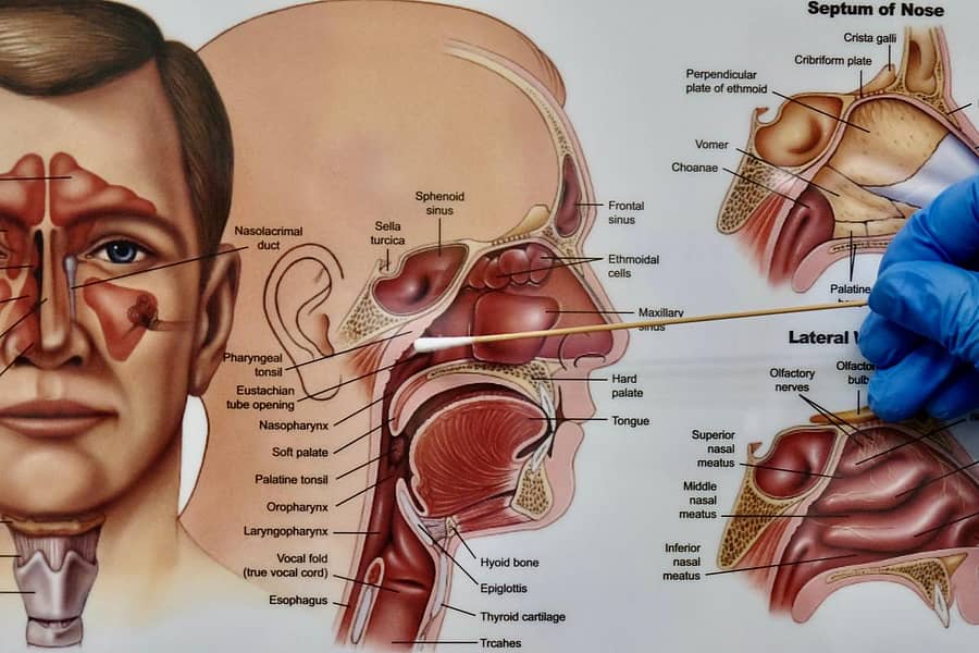 ಪ್ರಾತಿನಿಧಿಕ ಚಿತ್ರ