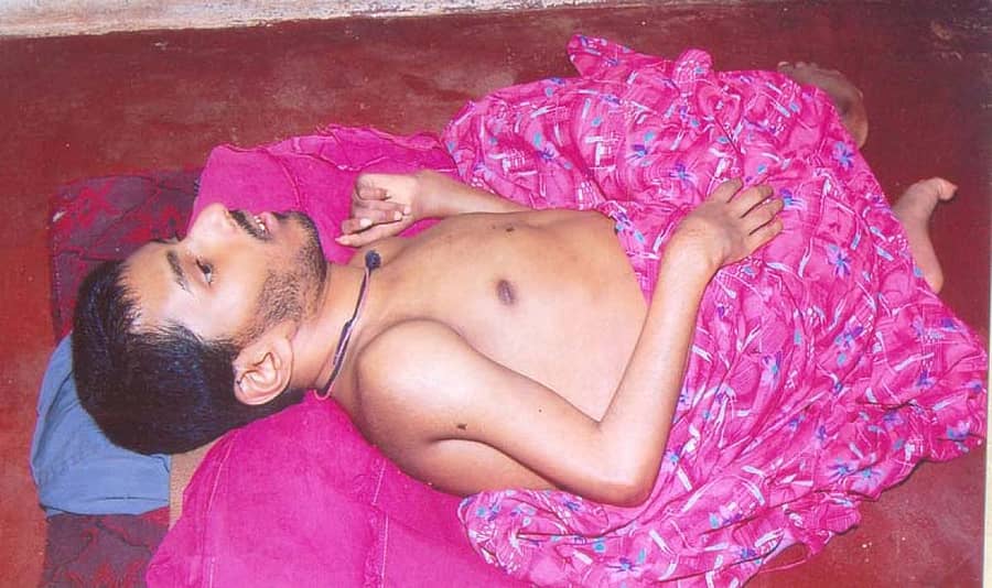 ಎಂಡೋ ಸಲ್ಫಾನ್ ಬಾಧಿತ ವ್ಯಕ್ತಿ