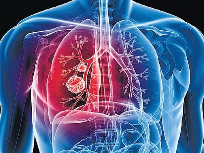 ಪ್ರಾತಿನಿಧಿಕ ಚಿತ್ರ