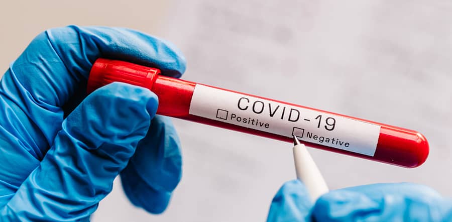 ಪ್ರಾತಿನಿಧಿಕ ಚಿತ್ರ