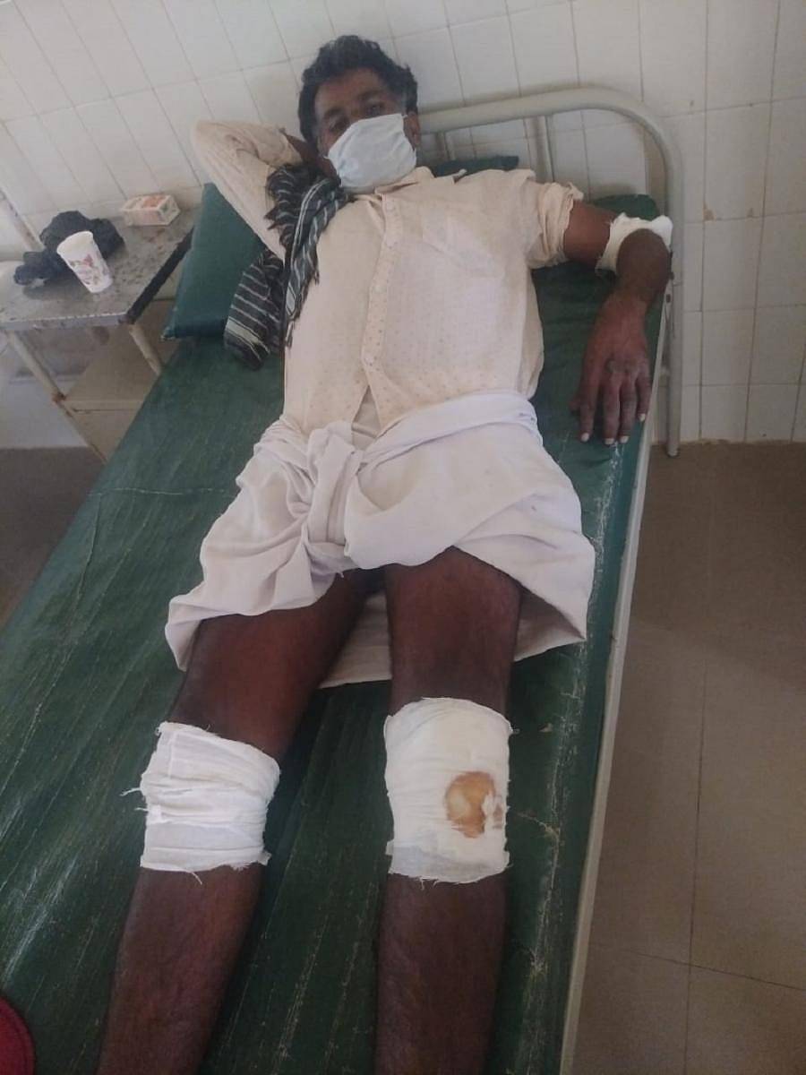 ಗುಂಡ್ಲುಪೇಟೆಯಲ್ಲಿ ಶುಕ್ರವಾರ ವೇಗವಾಗಿ ಸಾಗುತ್ತಿದ್ದ ಟಿಪ್ಪರ್ ತಗುಲಿ ಗಾಯಗೊಂಡ ಬೈಕ್ ಸವಾರ