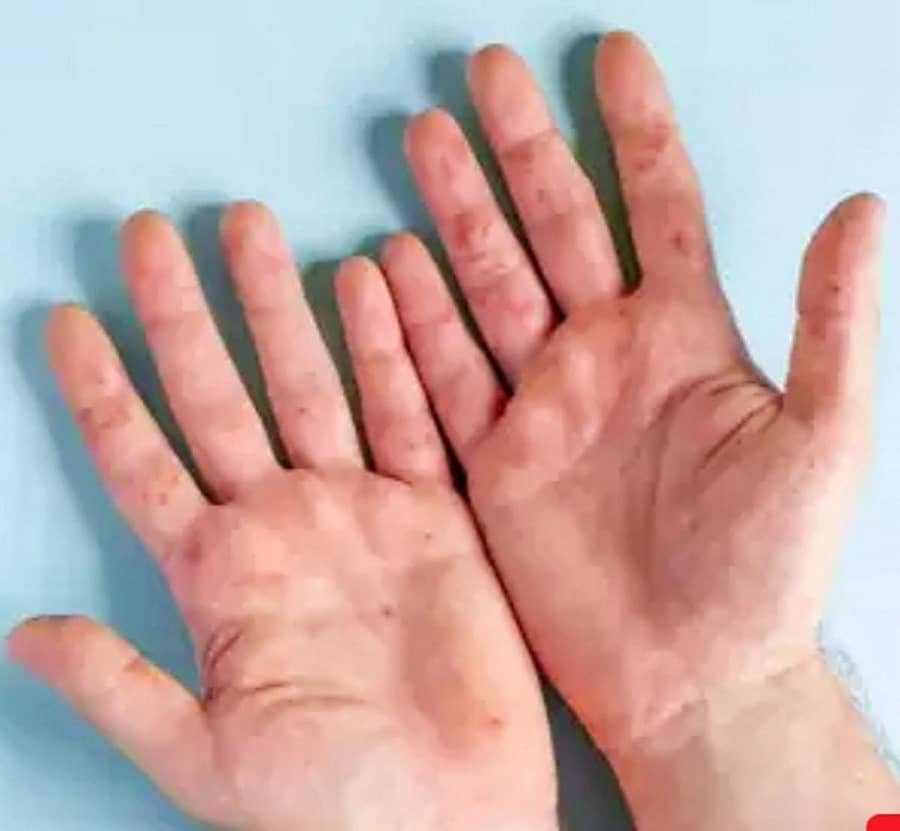 ಸಾಂದರ್ಭಿಕ ಚಿತ್ರ