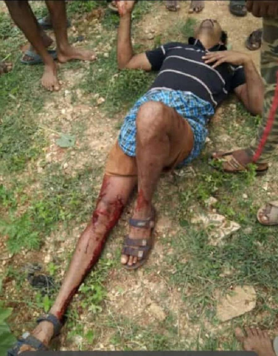 ಹುಲಿ ದಾಳಿಯಲ್ಲಿ ರೈತ ರಾಜಶೇಖರ ಅವರು ಗಾಯಗೊಂಡಿರುವುದು