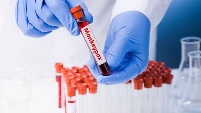 ಸಾಂದರ್ಭಿಕ ಚಿತ್ರ