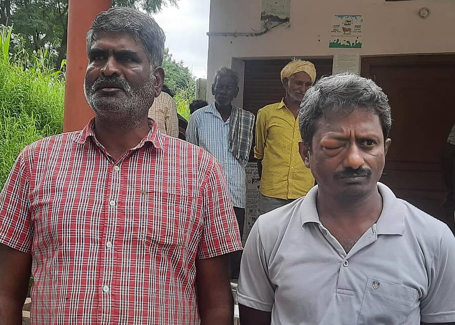 ಹಲ್ಲೆಗೊಳಗಾದ ಕನ್ನಸಂದ್ರದ ಎಂಪಿಸಿಎಸ್‌ ಕಾರ್ಯದರ್ಶಿ ಸತೀಶ್‌ ಕೆ.ಎಸ್‌.