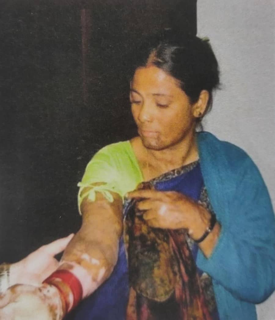 ಶಸ್ತ್ರ ಚಿಕಿತ್ಸೆ ನಂತರ