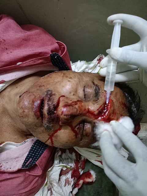 लाँच थाना अंतर्गत ग्राम कुलैंथ मे  दो पक्षो मे जमीनी विवाद